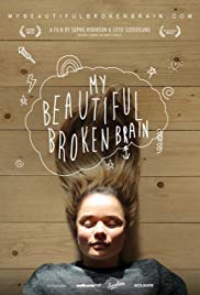 My Beautiful Broken Brain (2014) M4uHD Free Movie
