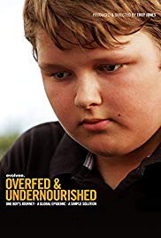 Overfed & Undernourished (2014) M4uHD Free Movie