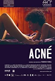 Acné (2008) Free Movie