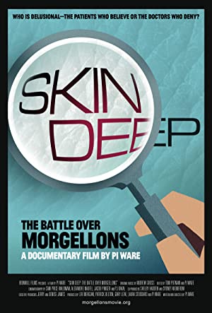 Skin Deep: The Battle Over Morgellons (2019) M4uHD Free Movie