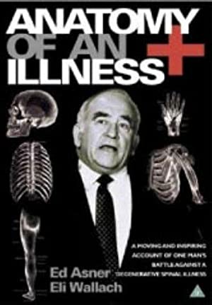 Anatomy of an Illness (1984) Free Movie M4ufree
