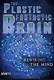 The Plastic Fantastic Brain (2009) M4uHD Free Movie